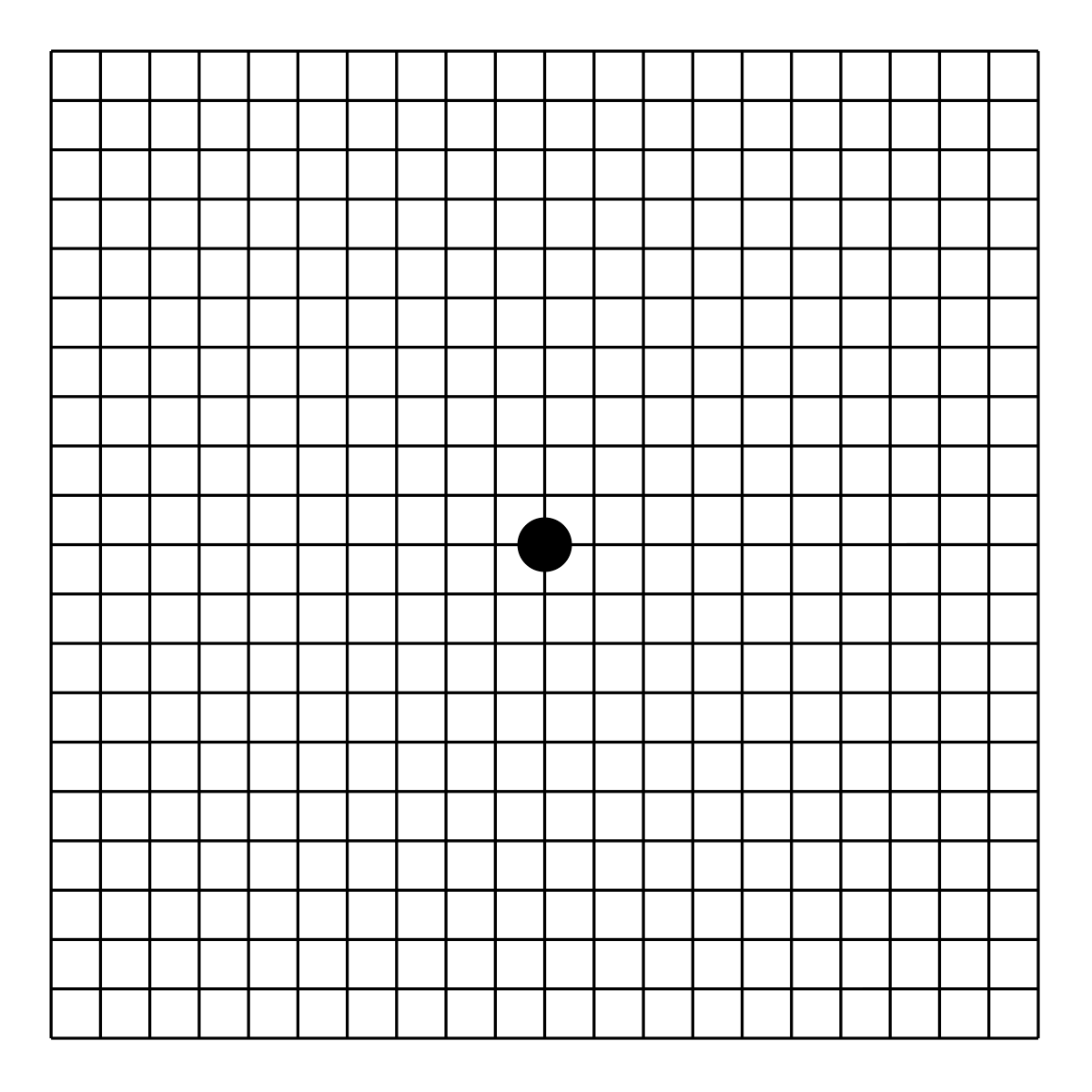 Таблица Амслера. Amsler Grid. Тест Амслера для глаз на зрение. Макулодистрофия тест Амслера.